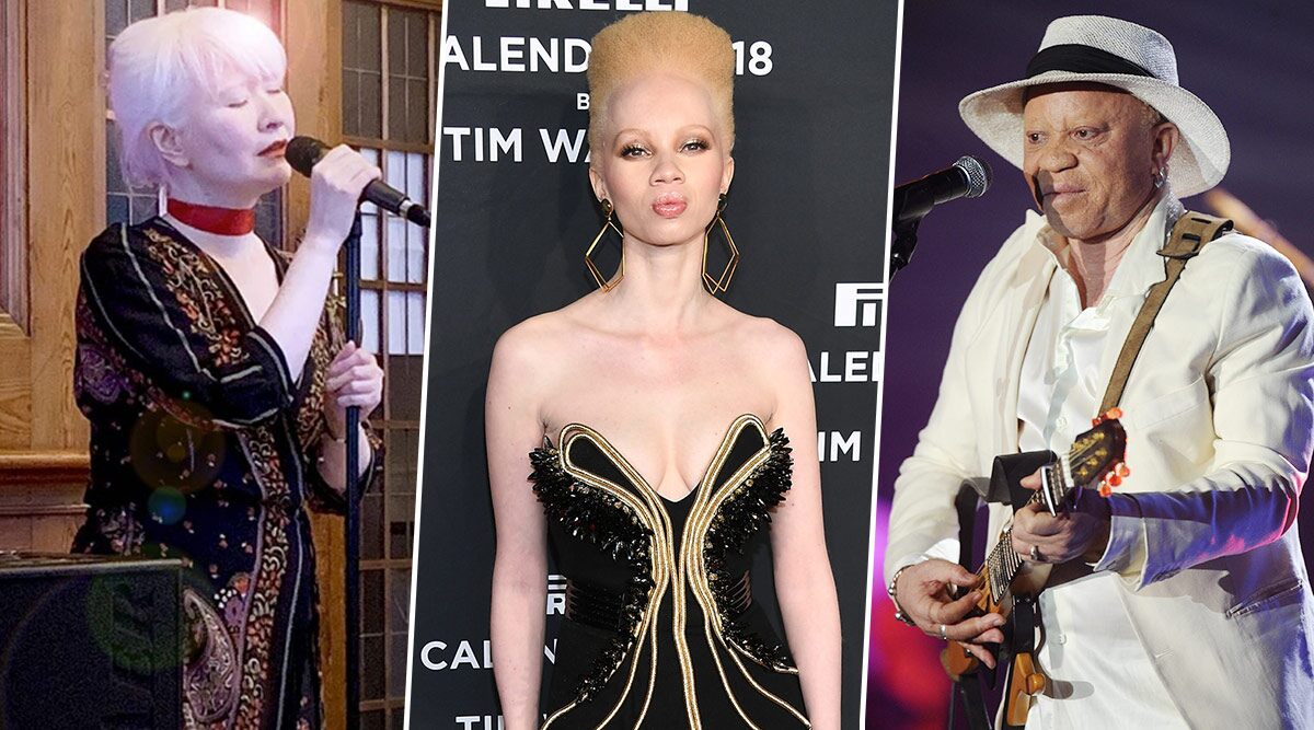 International Albinism Awareness Day 2020: Famous Albino Personalities Who Didn't Let Their Skin Disorder Hamper Their Big Dreams