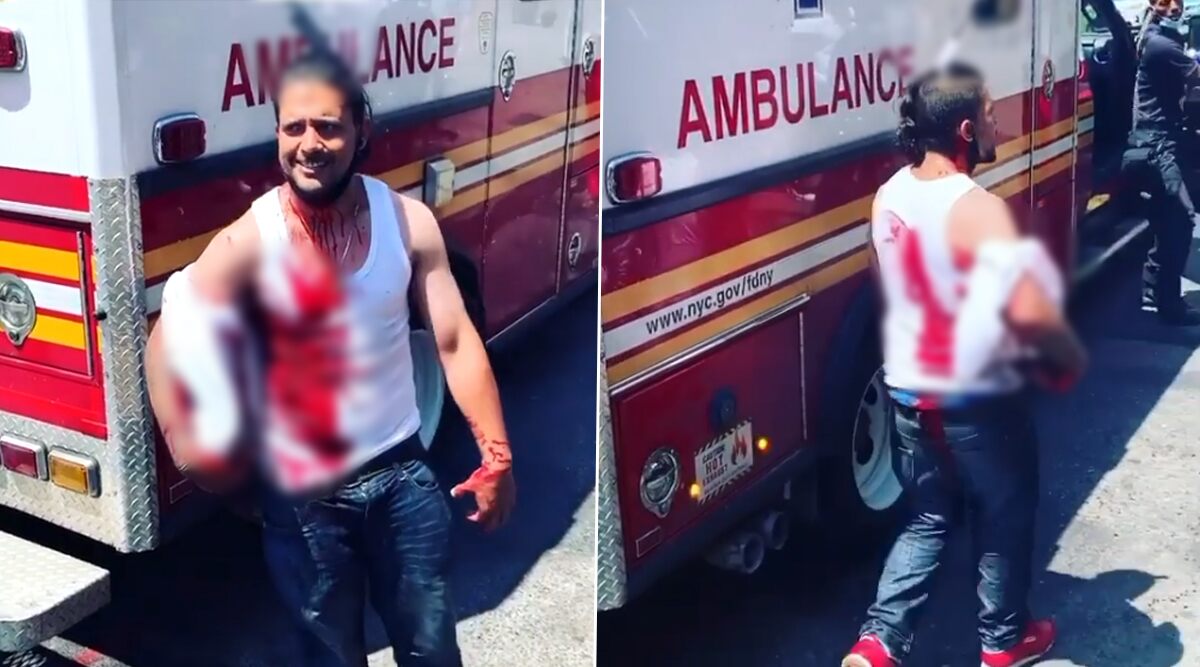 New York Man Walks With Knife Stuck on His Head, Seeks Help From Nearest Ambulance