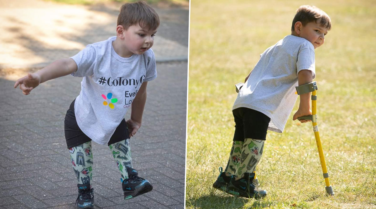 Remember Tony Hudgell? Inspired by WWII Veteran Captain Tom Moore, 5-Year-Old Double Amputee Boy Raises £1 Million for Hospital by Walking 10 Km on His Prosthetic Legs (Watch Video)