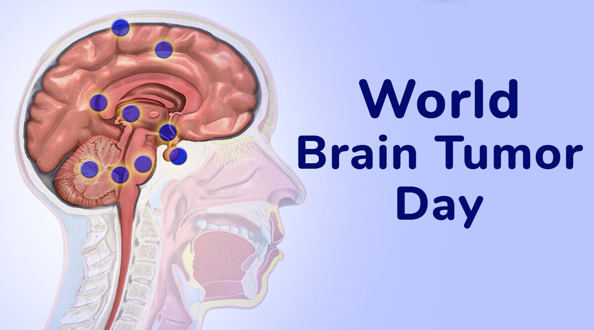 World Brain Tumor Day 2020 History and Significance: Know More About the Day Observed To Raise Public Awareness About Brain Tumour