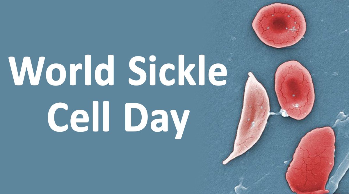 World Sickle Cell Day 2020 Date, History & Significance: What Is Sickle Cell Disease (SCD)? Symptoms and Treament Options You Should Know Of