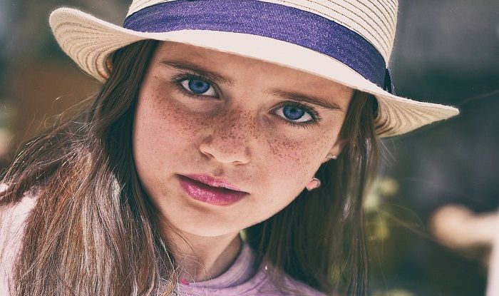 How to Remove Freckles Permanently And Get Spotless Skin