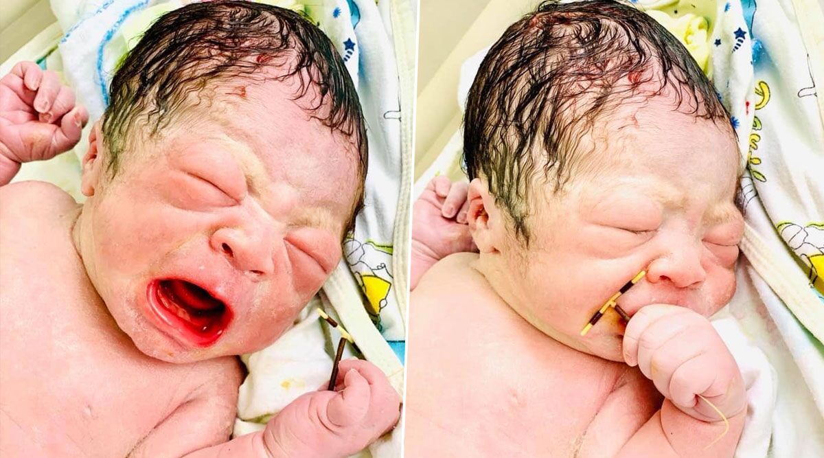 Oops! Newborn Baby Poses With Mom's Contraceptive IUD in Hand, Funny Pics Goes Viral