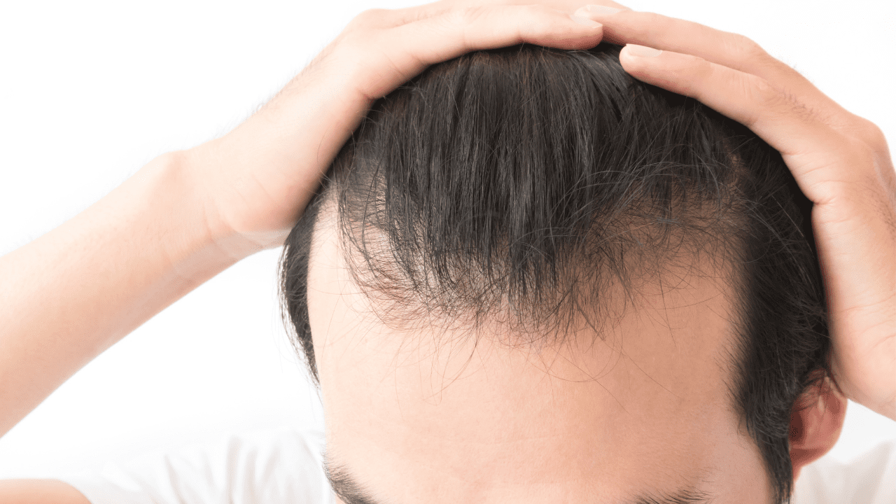Why is my hair suddenly started falling out? 5 causes of hair loss