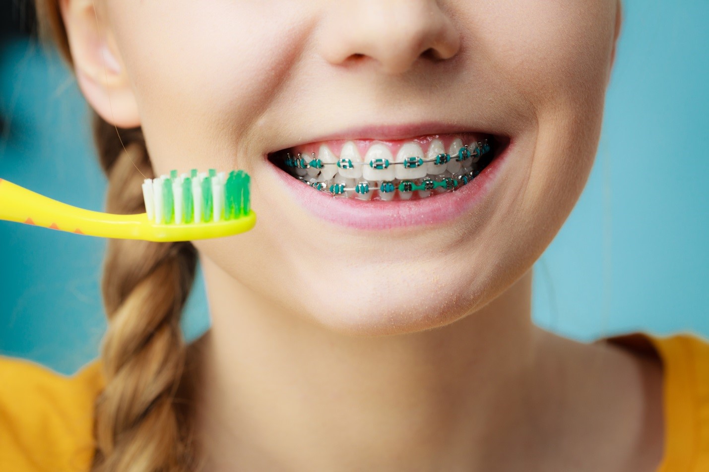 علاجات تقويم الأسنان للأطفال