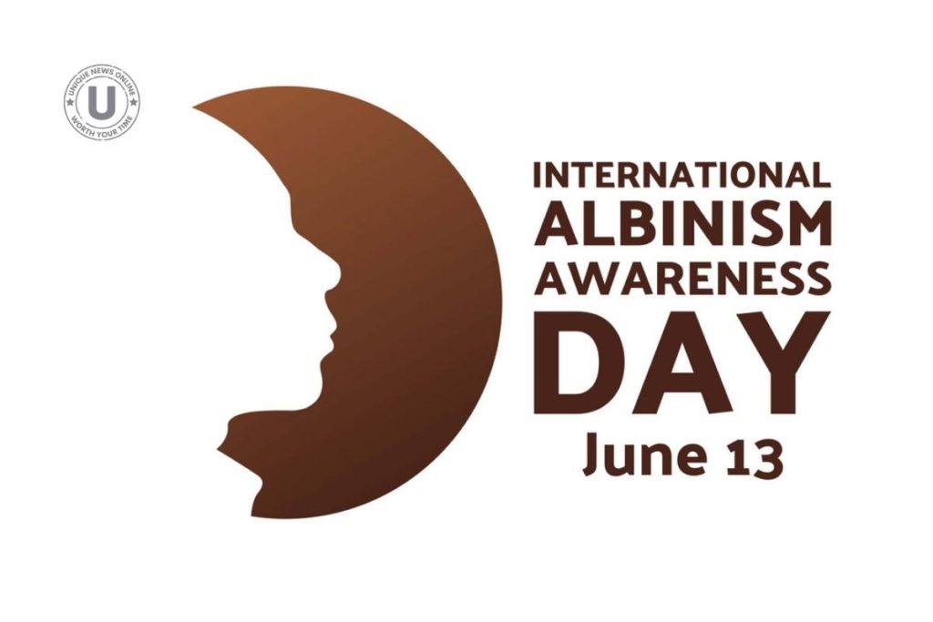 International Albinism Awareness Day 2022: Wishes