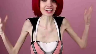 Anorexic Youtuber Eugenia Cooney's Reail-Thin Physique In Latest Viral Video Sparks Concerns About Her Health, Here's All About Her Disease