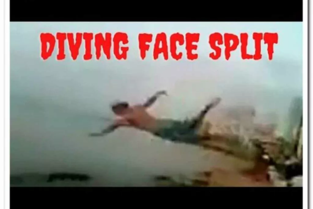 Face Split Diving Accident