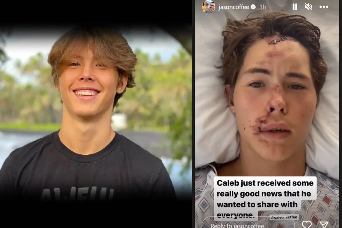 Caleb Coffee Accident: Did Caleb Coffee Die? What Happened To Tiktoker? Net Worth, Family, and All You Need To Know