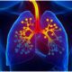 Asthma drug may help fight dangerous food allergy in kids: Study