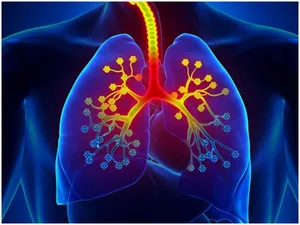 Inflammatory protein potential key to treating severe asthma: Study