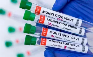 Cambodia reports 2 more cases of mpox