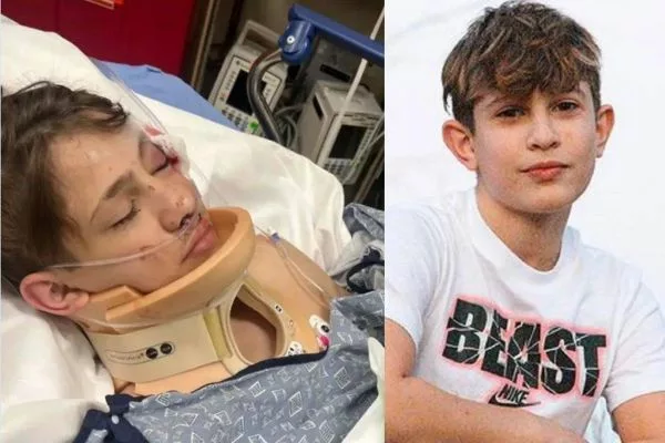 All About YouTuber Nidal Wonder As He Recovering From A Deadly Scooter Accident