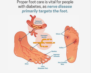 Here's how to take care of your foot health if you have diabetes
