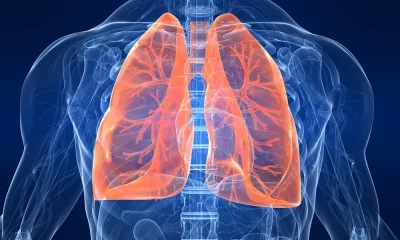 Study links colourless, odourless gas with the rise in lung cancers
in non-smokers