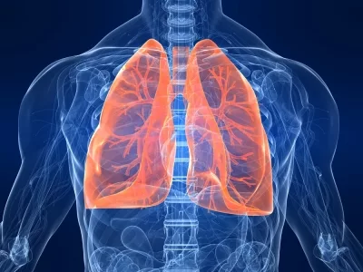 Study links colourless, odourless gas with the rise in lung cancers
in non-smokers