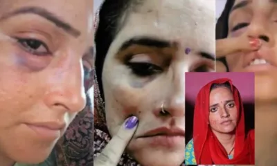 Video of Seema Haider with bruised lip and eye goes viral on the internet 