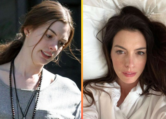 10 Anne Hathaway No-Makeup Images