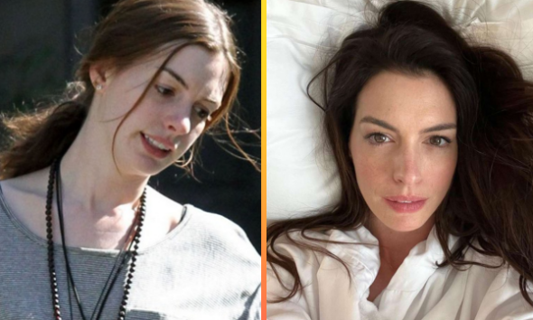 10 Anne Hathaway No-Makeup Images